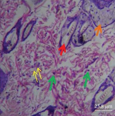 Histological section of the dermis showing pilosebaceous unit... | Download Scientific Diagram