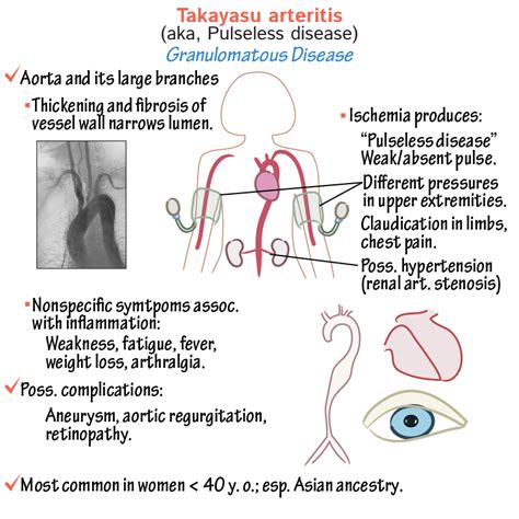 Pathology Glossary: Takayasu arteritis | Draw It to Know It