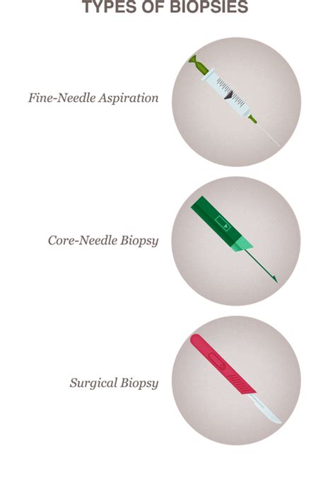 Biopsy - National Breast Cancer Foundation