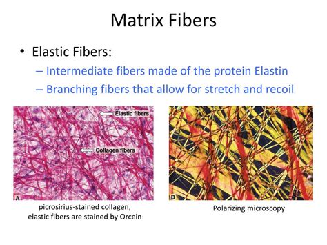 PPT - Connective Tissue PowerPoint Presentation, free download - ID:1974907