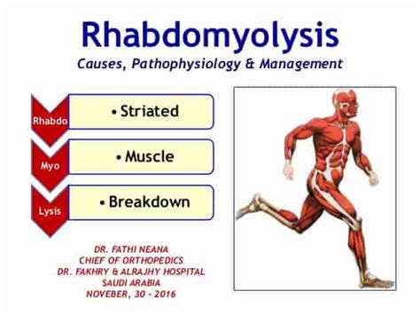 Rhabdomyolysis: Symptoms, Causes, and Treatments