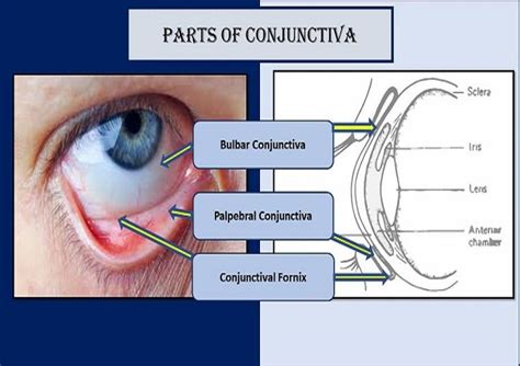 Bulbar Conjunctiva, Palpebral Conjunctiva and Fornix of Eye | Health Kura