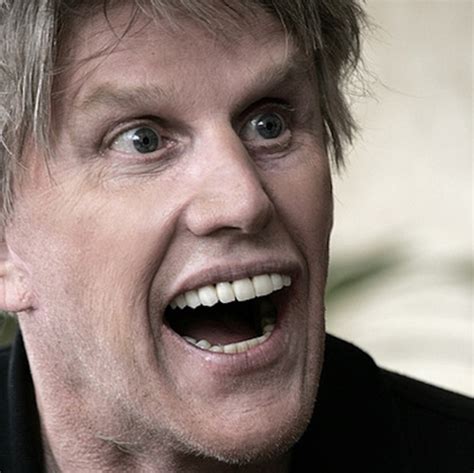 Gary Busey Brain Injury