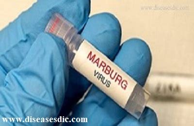 Marburg Virus Disease - Symptoms, Treatment, and Prevention.