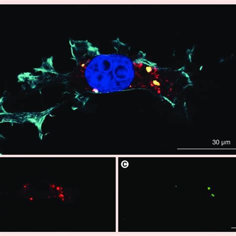 Confocal fluorescence imaging of nanodiamonds in cells. (A) The... | Download Scientific Diagram