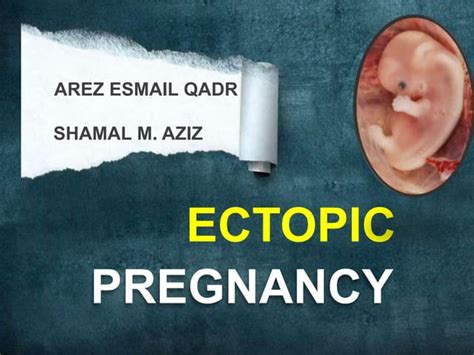 Methotrexate in Ectopic Pregnancy