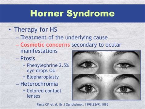 Horner Syndrome