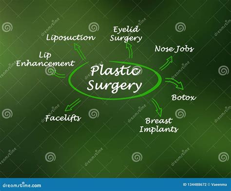 Types of Plastic Surgery stock illustration. Illustration of aesthetic - 134488672