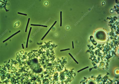 LM of Lactobacillus bulgaricus bacteria - Stock Image - B220/0069 ...