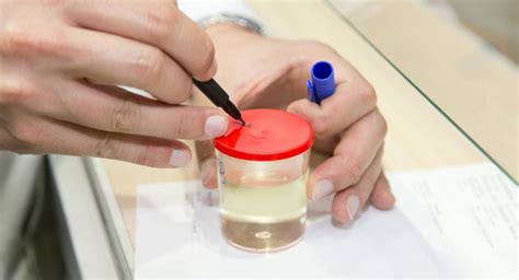 Routine urine tests during pregnancy | BabyCenter