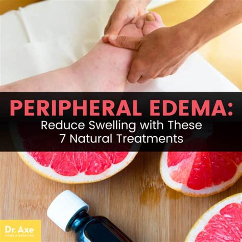 Peripheral Edema Symptoms + 7 Natural Treatments - Dr. Axe