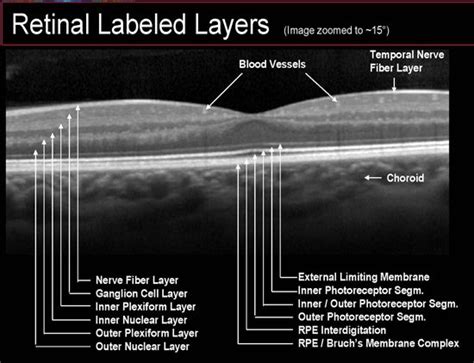 Layers of the Retina Oct | Oct Retinal Layers | Eye facts, Optometry ...