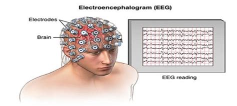 An illustration of EEG recording | Download Scientific Diagram