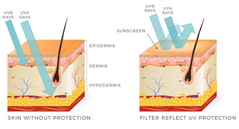 Ultra Violet (UV) Rays - MyDoc Urgent Care