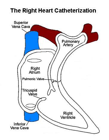 CardiacCathPro.com