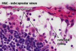 macrophage histology - Google Search | Connective Tissue | Pinterest | Search