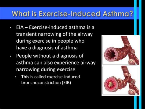 PPT - Exercise-Induced Asthma PowerPoint Presentation, free download ...