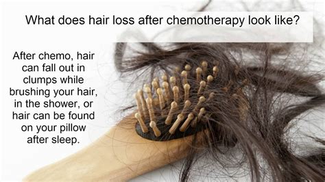 Hair loss from chemotherapy: what is it? who gets it? how do we treat it? - YouTube