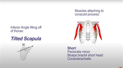 Superior Angle Of Scapula Muscle