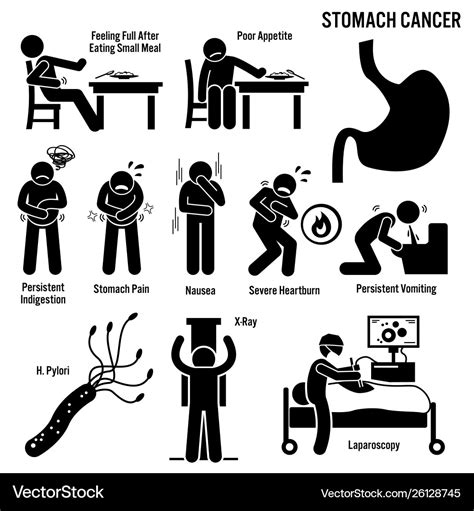 Stomach cancer symptoms causes risk factors Vector Image