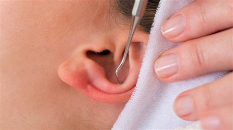 Ear Blackhead Removal Video