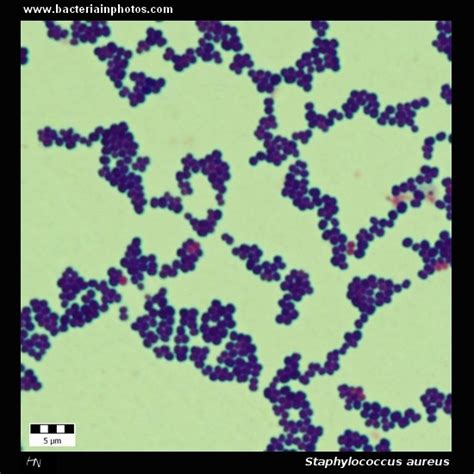 Staphylococcus aureus under microscope: microscopy of Gram-positive ...