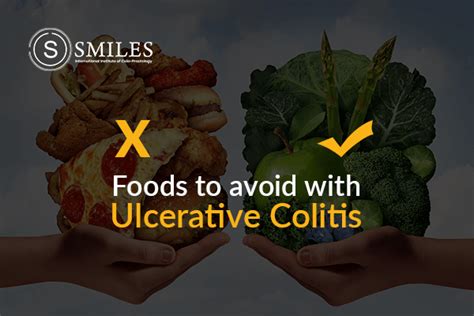 Foods To Avoid During Ulcerative Colitis | SMILES