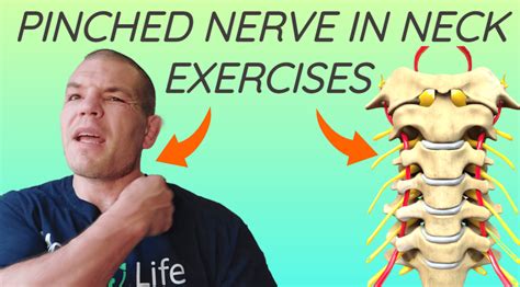 Pinched Nerve In Neck Exercises | Relieve Pinched Nerve Pain