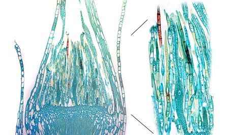 ‎Mnium moss - longitudinal section through the apex of a female ...