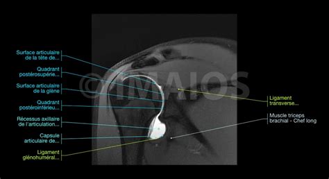 Epaule Arthro IRM : anatomie normale | e-Anatomy