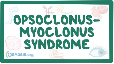 Opsoclonus myoclonus syndrome (NORD): Video & Anatomy | Osmosis