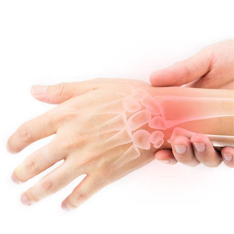 Wrist Fracture | Lancaster Orthopedic Group, Lancaster County, PA - Lancaster Orthopedic Group