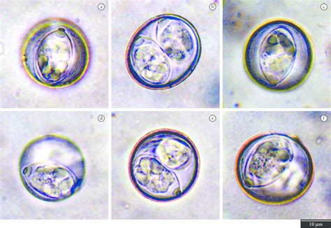 Photographs of sporulated oocysts of coccidia species recovered from... | Download Scientific ...