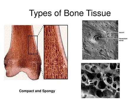 PPT - What do you know about BONES ? PowerPoint Presentation, free download - ID:2754411