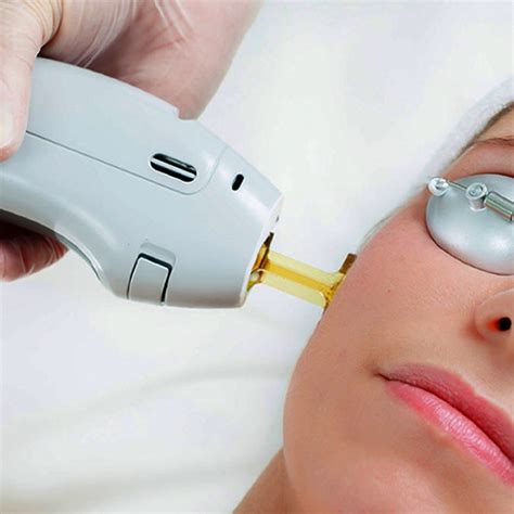 Q-Switch Laser - Cosmetic Laser & Skin Clinic