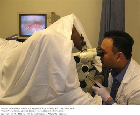 Colposcopy—Normal and Noncancerous Findings | Basicmedical Key