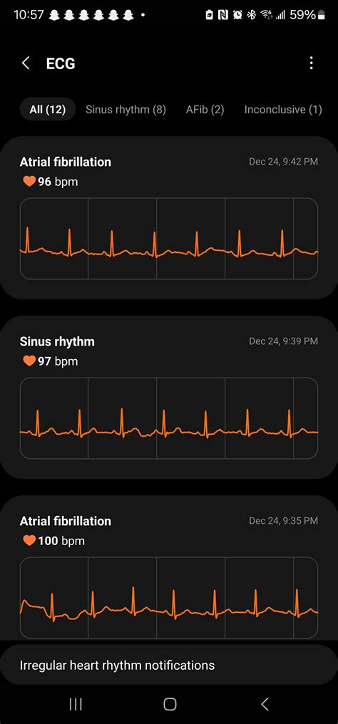 Is this afib? : r/GalaxyWatch