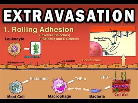 EXTRAVASATION - YouTube