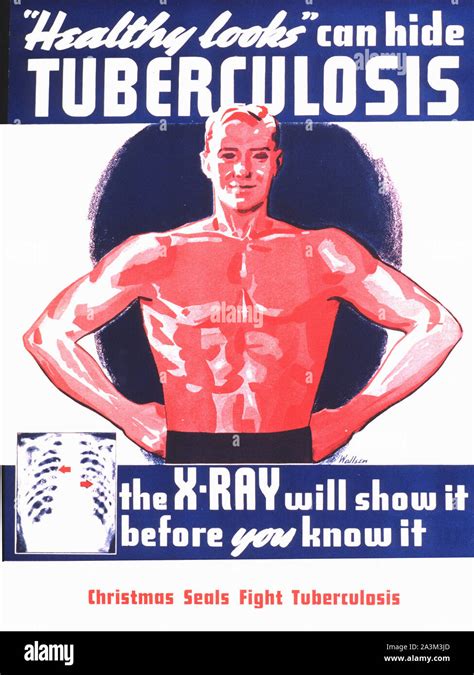 Tuberculosis X-Ray - Vintage poster Stock Photo - Alamy