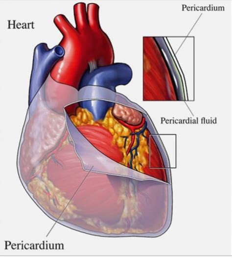 Pericardial Diseases | Dr Krasopoulos