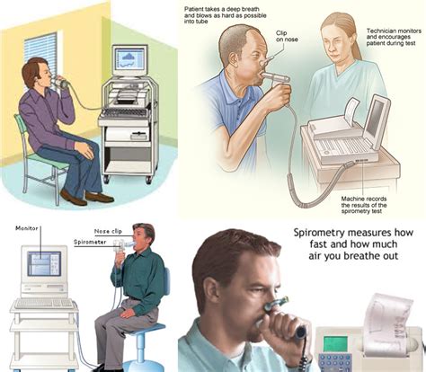 Diagnosing Legionnaires Disease with Pulmonary Function Test