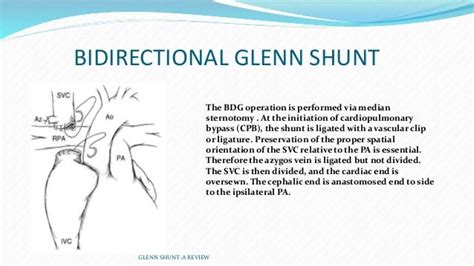 Glenn shunt a review