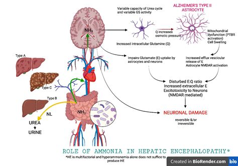 Pathology Outlines - Hepatic encephalopathy