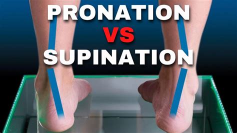 The difference between supination, pronation and over-Pronation - YouTube