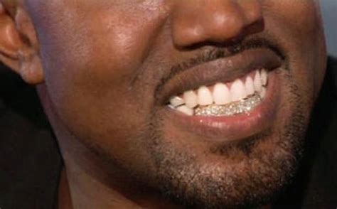 Gold Teeth Grillz Facts - Everything you wanted to know ... on Strikingly