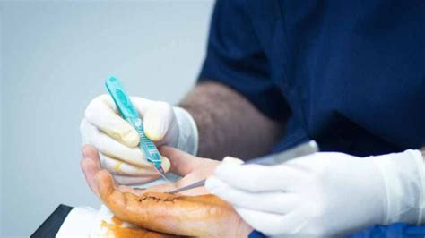 Top 7 Essential Questions You Should Ask Before a Hand Surgery