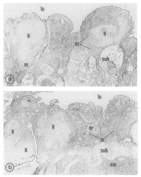 Electron micrograph of the (a) umbilical artery and (b) umbilical vein ...