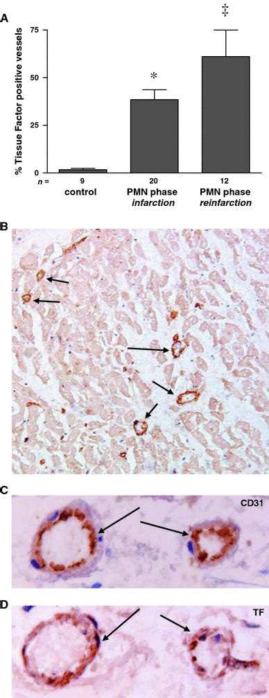 Tissue Factor expression in the human myocardium. a Percentage of ...