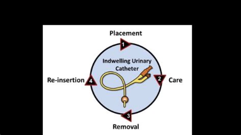 Episode 27: Indwelling Urinary Catheters: Current evidence for common clinical practices. - YouTube