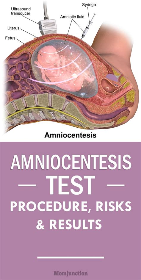 Amniocentesis Test: Procedure, Risks & Results : Did your doctor recommended Amniocentesis test ...